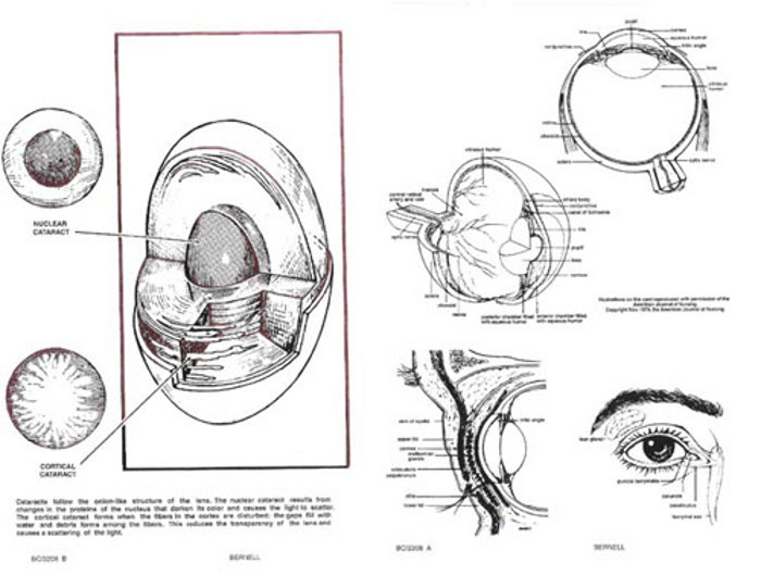 BC2208 X Section Cut Away